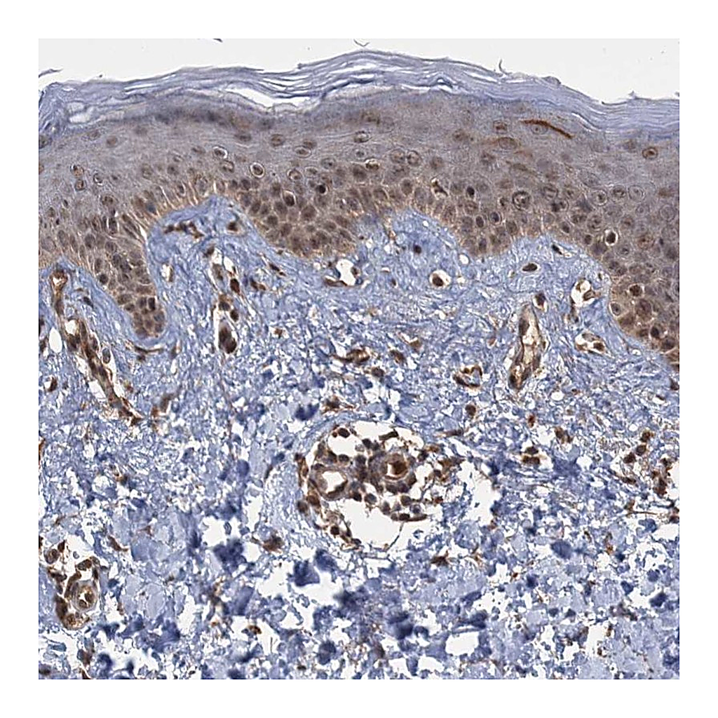 Atlas Antibodies Anti-KANSL2 Antibody