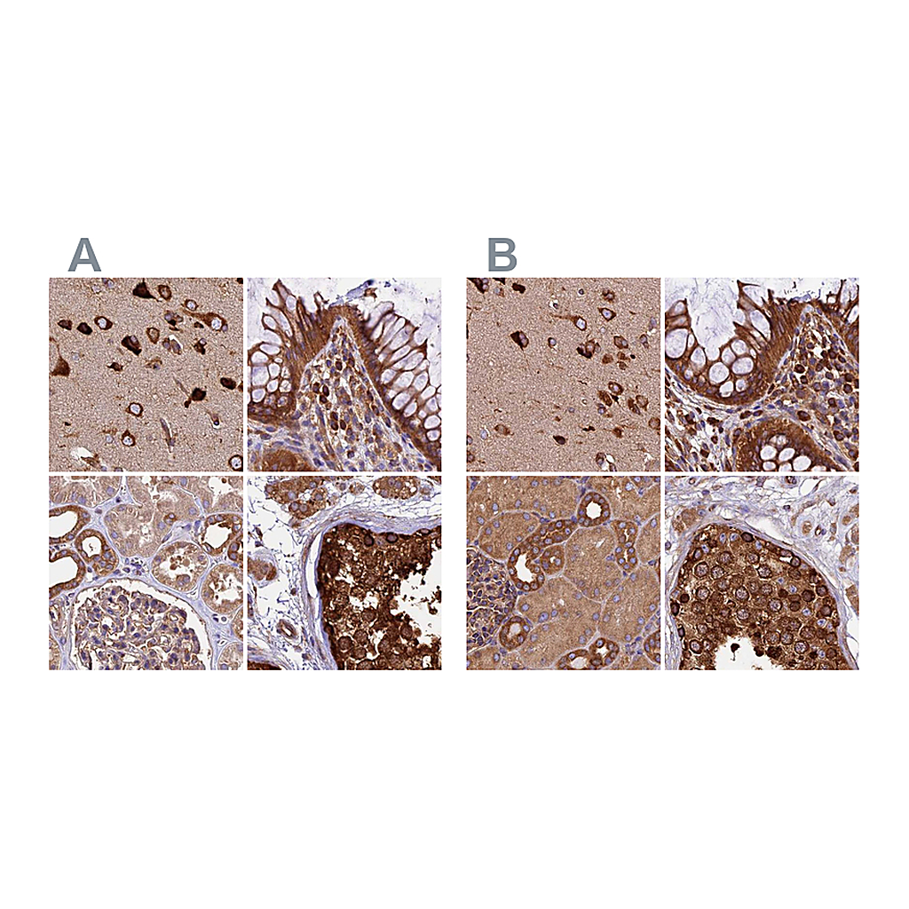 Atlas Antibodies Anti-KARS Antibody