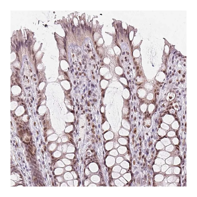 Atlas Antibodies Anti-KAT6A Antibody