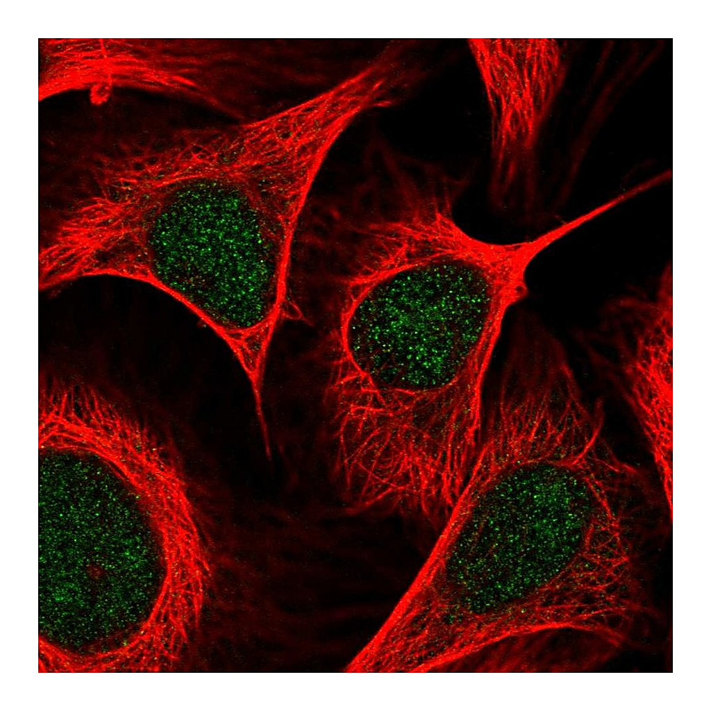 Atlas Antibodies Anti-KAT2B Antibody