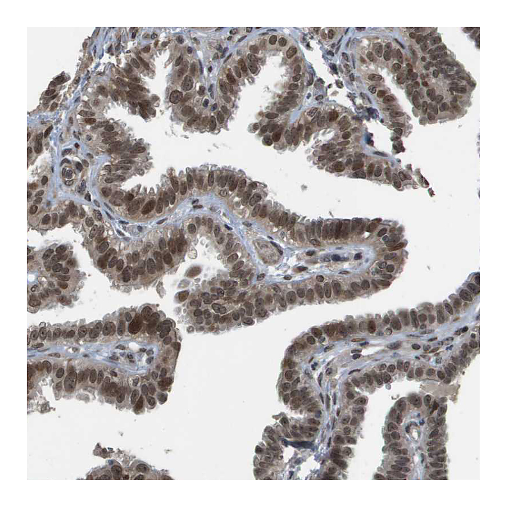 Atlas Antibodies Anti-KAT5 Antibody
