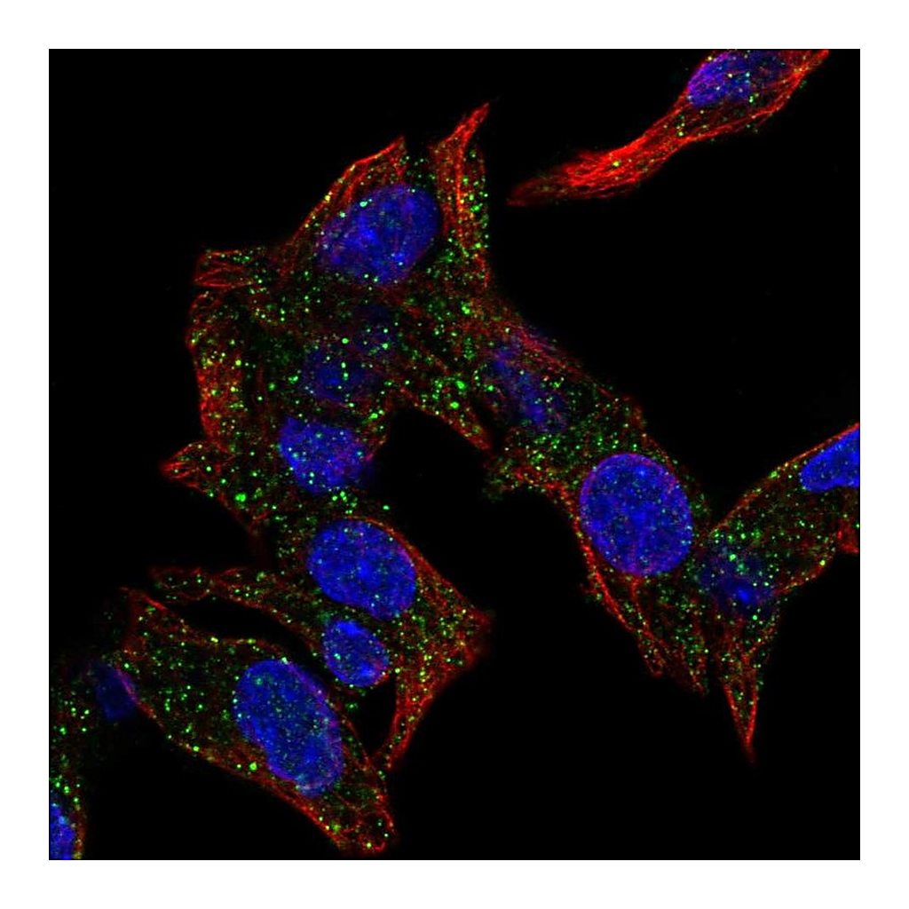 Atlas Antibodies Anti-KAT14 Antibody