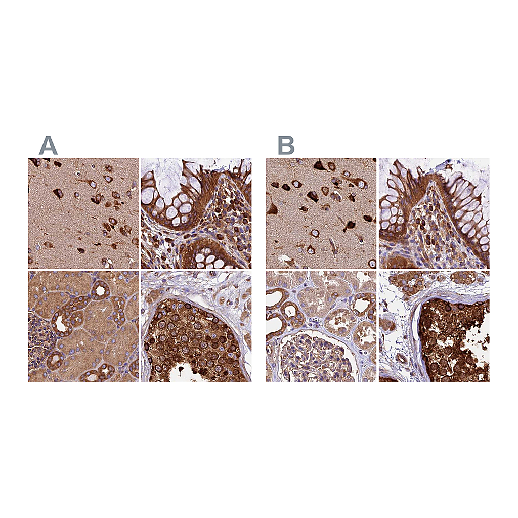 Atlas Antibodies Anti-KARS Antibody