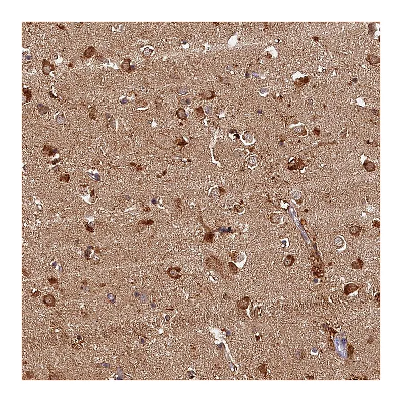 Atlas Antibodies Anti-KATNB1 Antibody