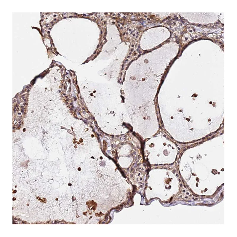 Atlas Antibodies Anti-KATNAL2 Antibody