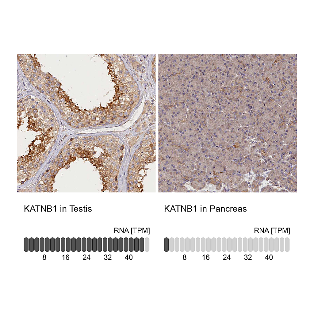Atlas Antibodies Anti-KATNB1 Antibody