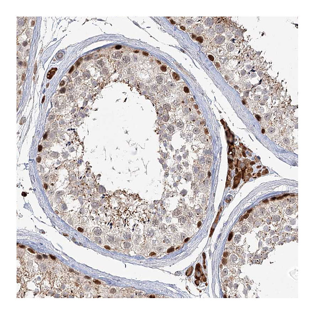 Atlas Antibodies Anti-KBTBD4 Antibody
