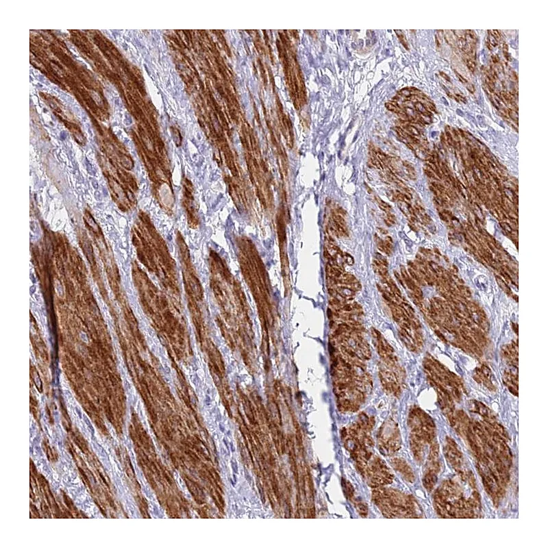 Atlas Antibodies Anti-KBTBD3 Antibody
