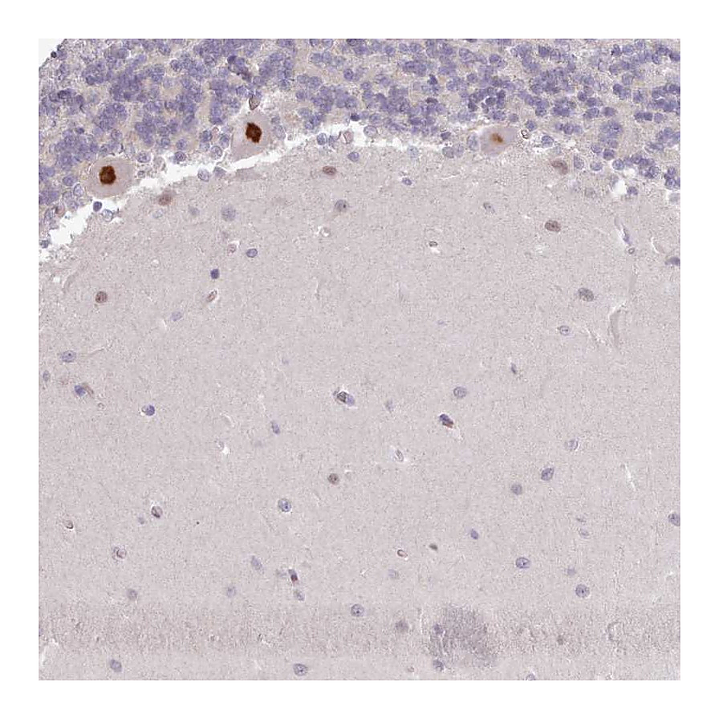 Atlas Antibodies Anti-KBTBD6 Antibody