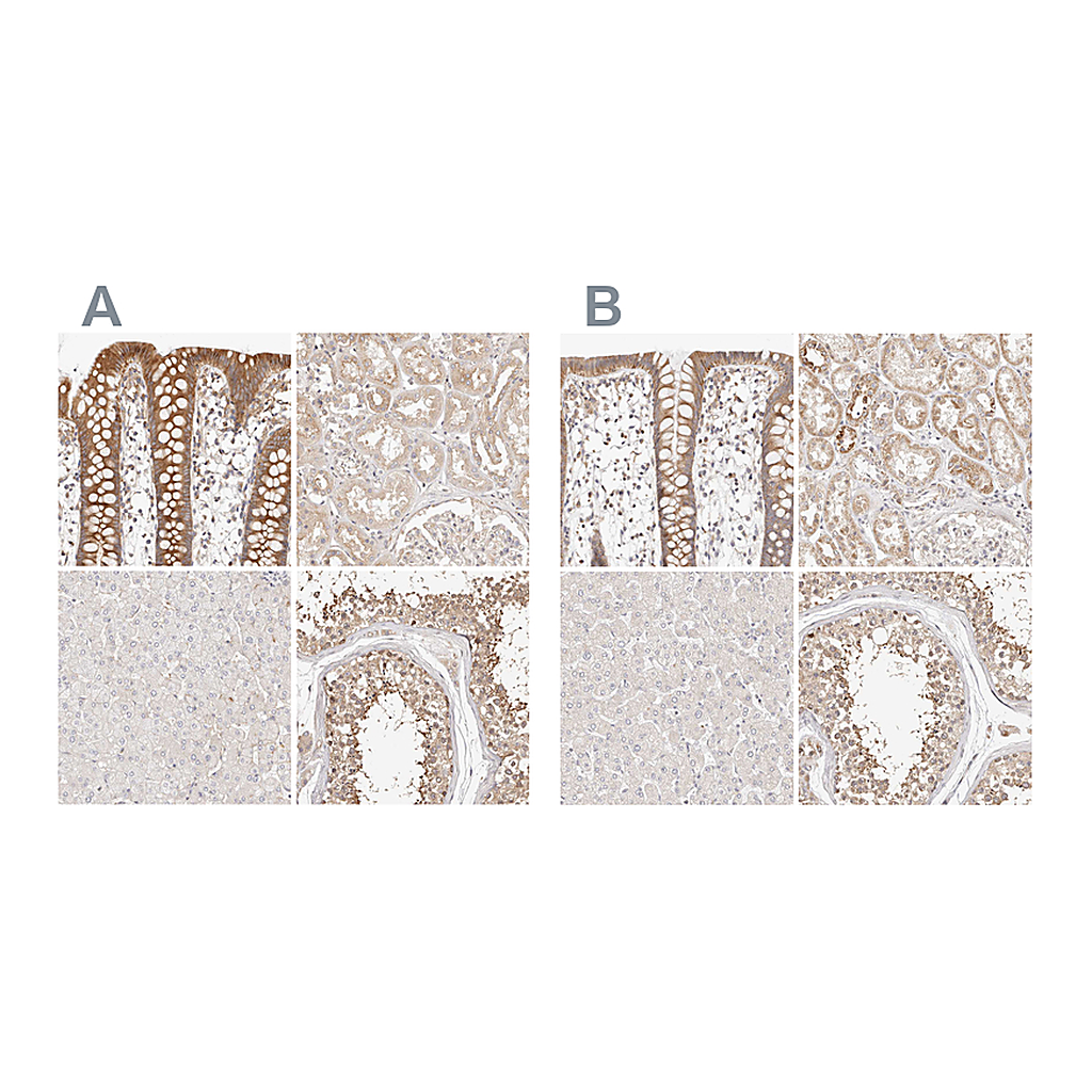 Atlas Antibodies Anti-KCMF1 Antibody