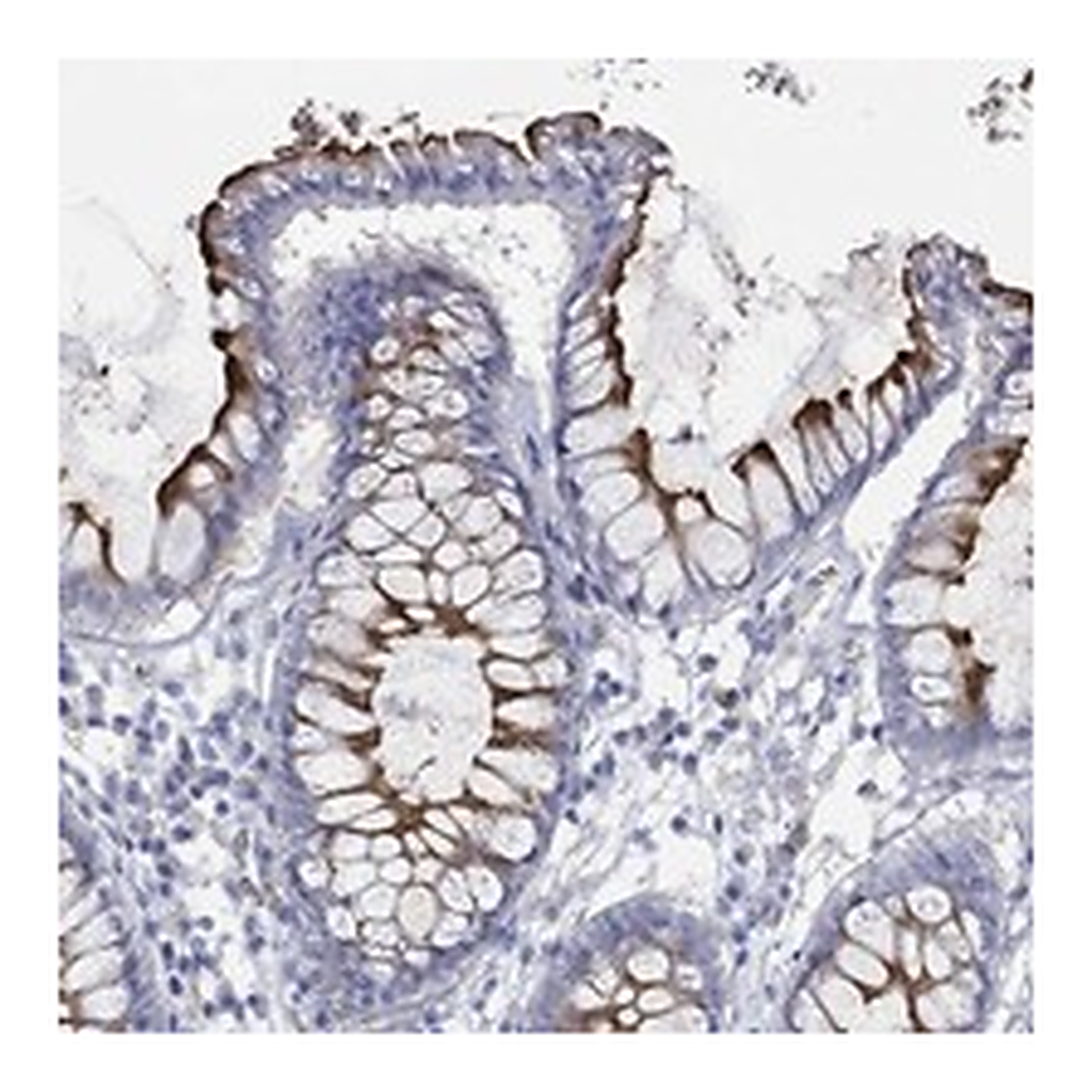 Atlas Antibodies Anti-KCNA1 Antibody