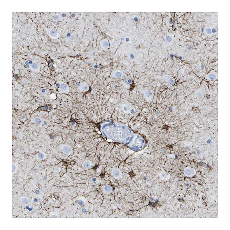 Atlas Antibodies Anti-KCNA3 Antibody