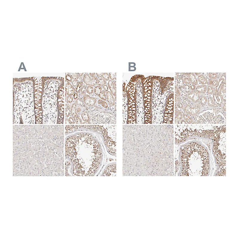 Atlas Antibodies Anti-KCMF1 Antibody