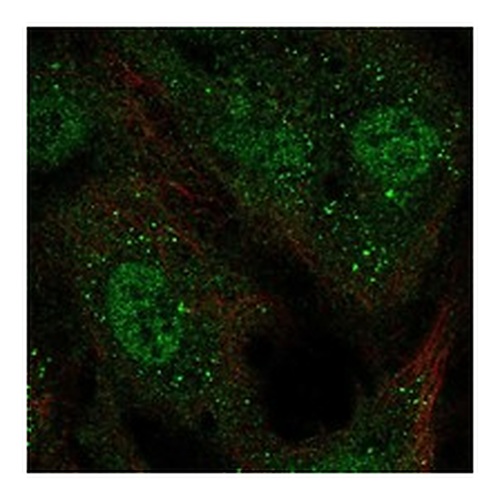 Atlas Antibodies Anti-KCNAB1 Antibody