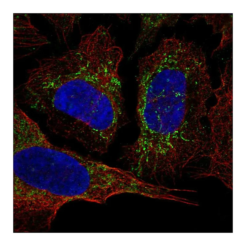 Atlas Antibodies Anti-KCNAB3 Antibody