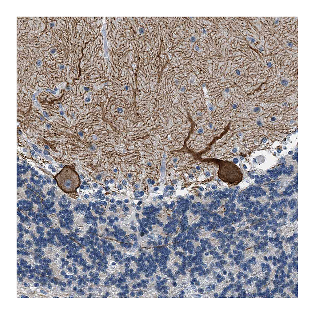 Atlas Antibodies Anti-KCNC3 Antibody