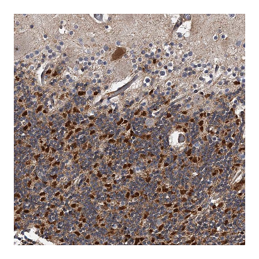 Atlas Antibodies Anti-KCND3 Antibody