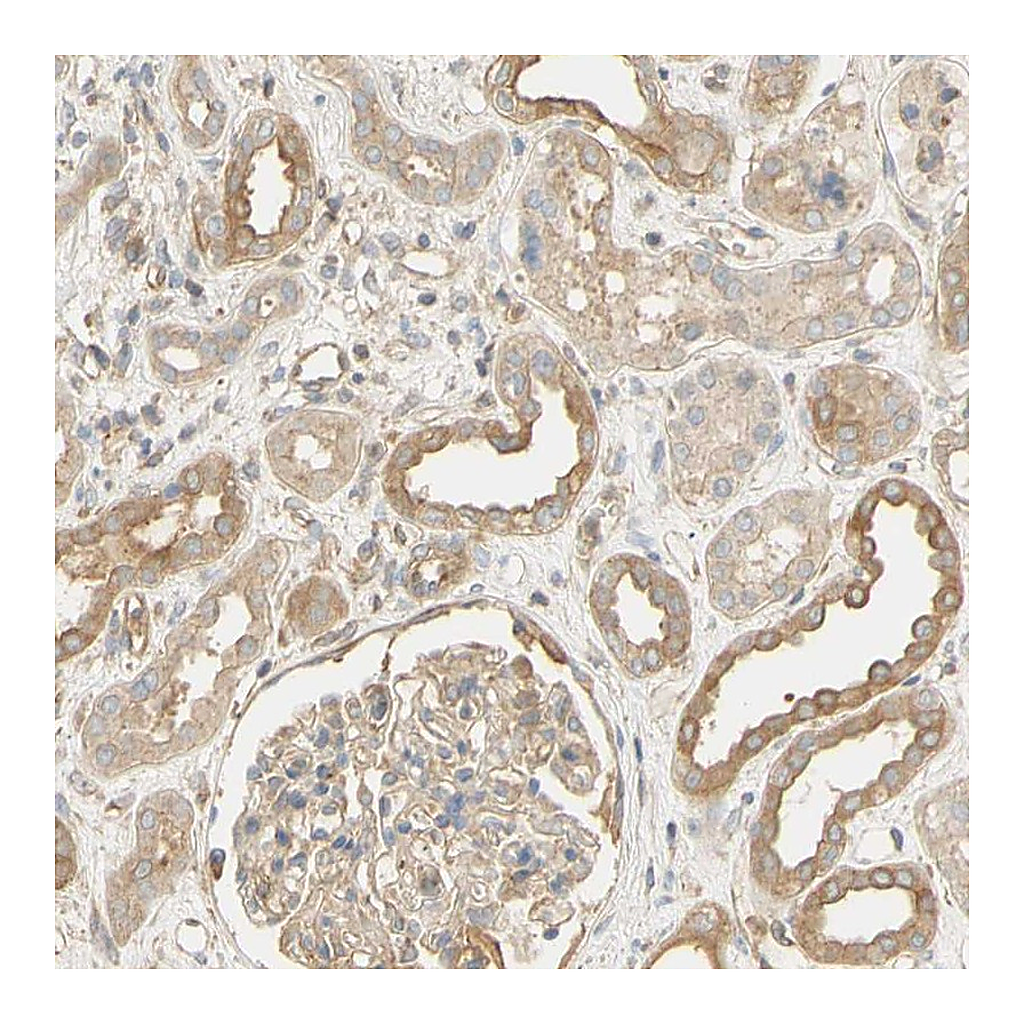 Atlas Antibodies Anti-KCNE4 Antibody