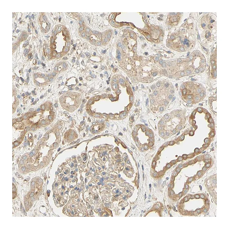 Atlas Antibodies Anti-KCNE4 Antibody