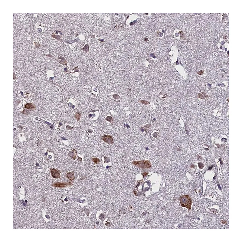 Atlas Antibodies Anti-KCNE5 Antibody