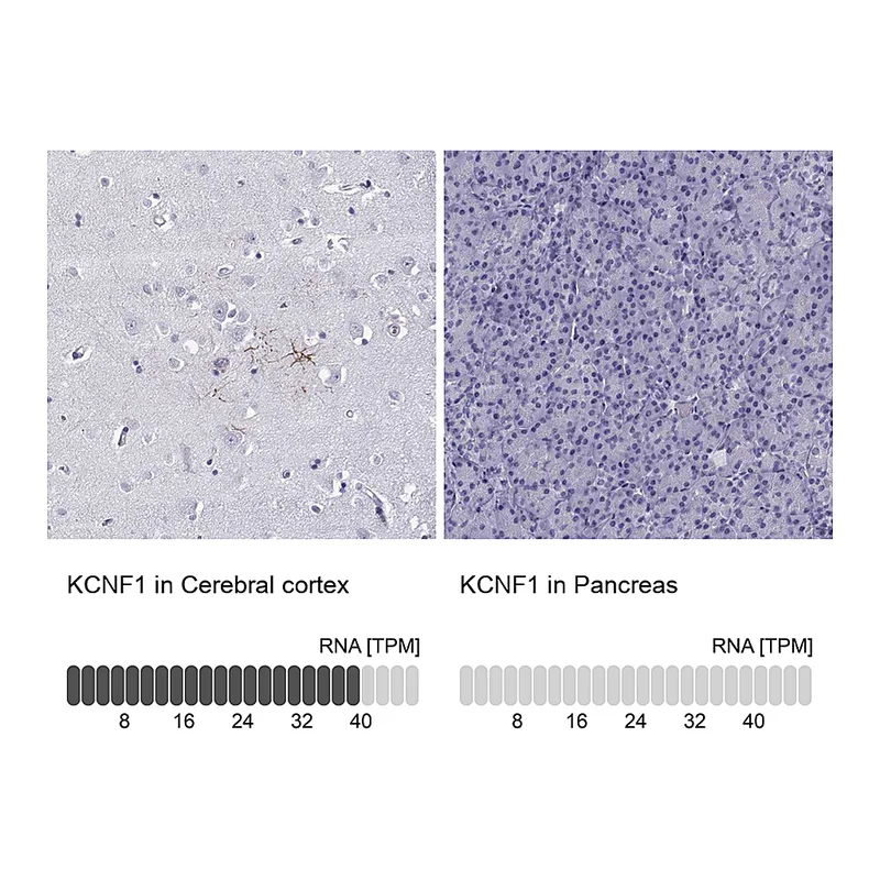 Atlas Antibodies Anti-KCNF1 Antibody