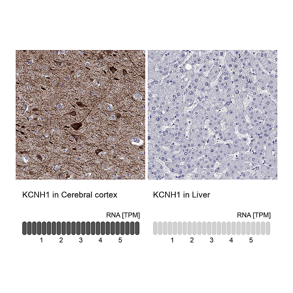 Atlas Antibodies Anti-KCNH1 Antibody