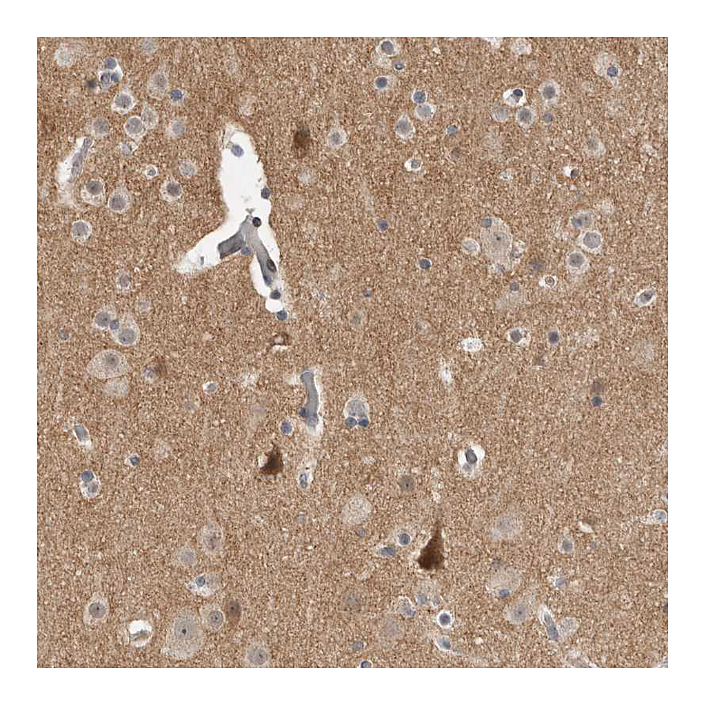 Atlas Antibodies Anti-KCNIP1 Antibody