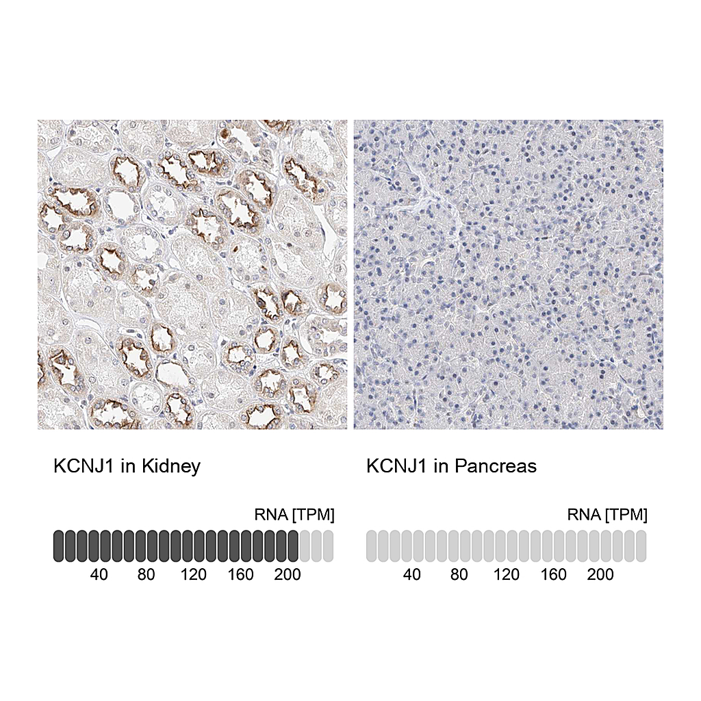 Atlas Antibodies Anti-KCNJ1 Antibody