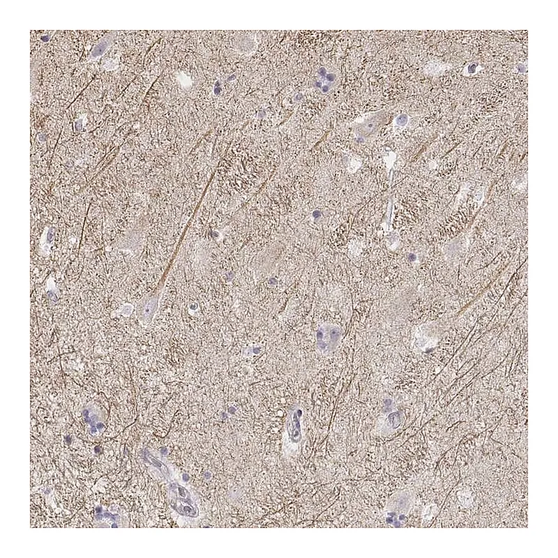 Atlas Antibodies Anti-KCNJ12 Antibody