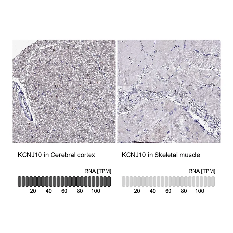 Atlas Antibodies Anti-KCNJ10 Antibody