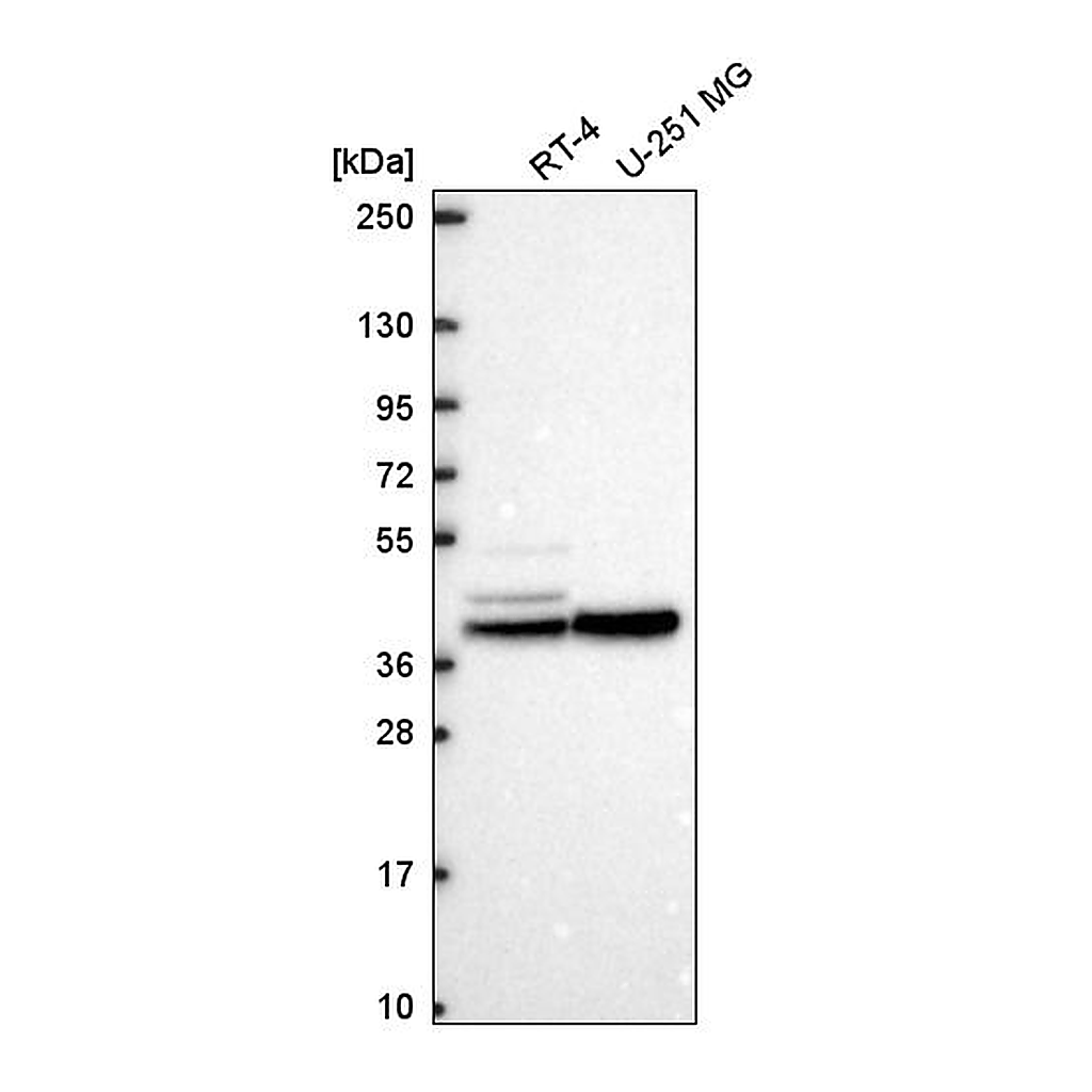 Atlas Antibodies Anti-KCNJ14 Antibody