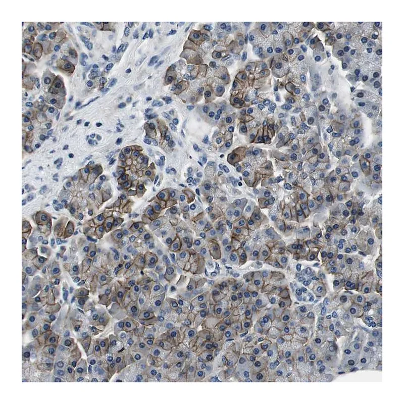 Atlas Antibodies Anti-KCNJ5 Antibody