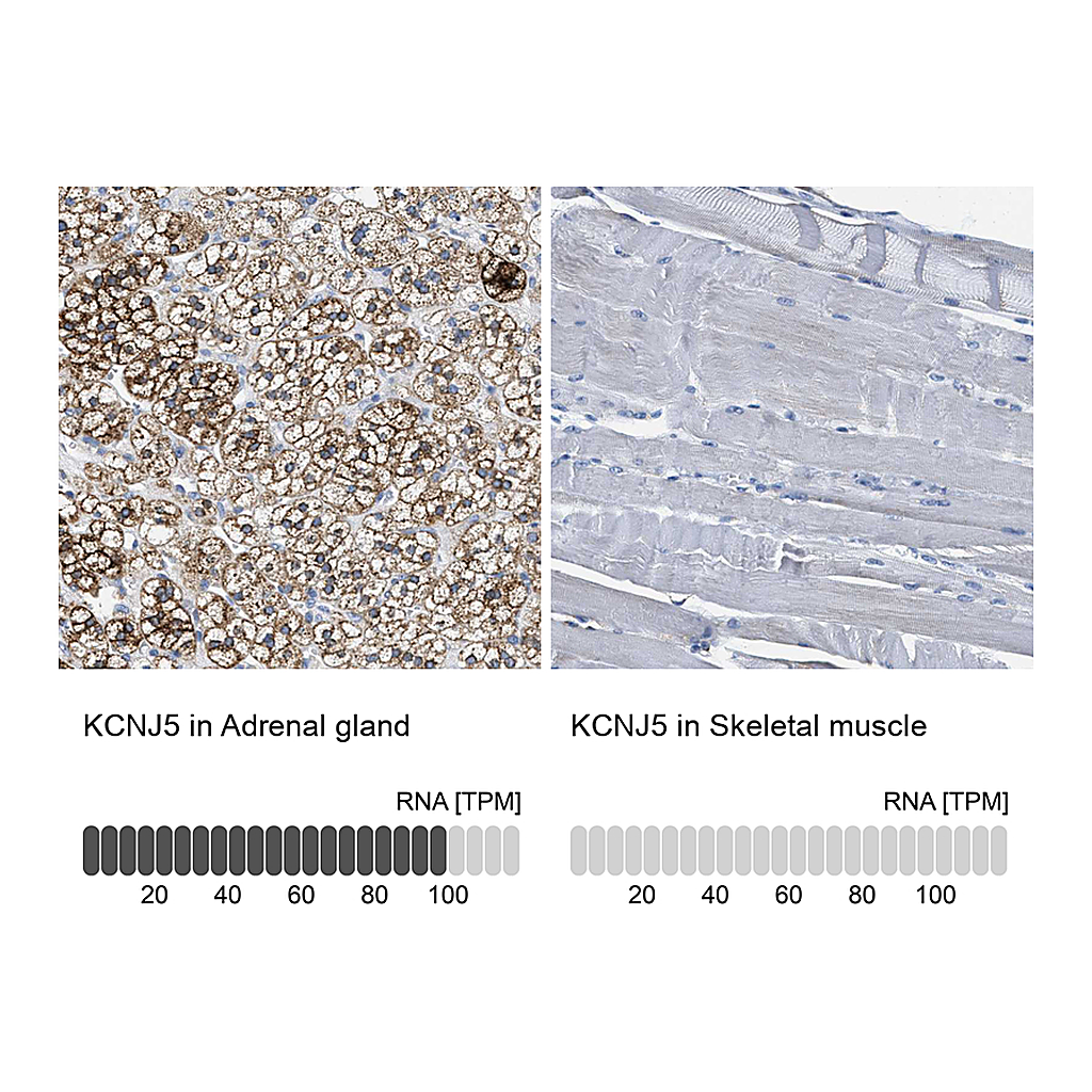 Atlas Antibodies Anti-KCNJ5 Antibody