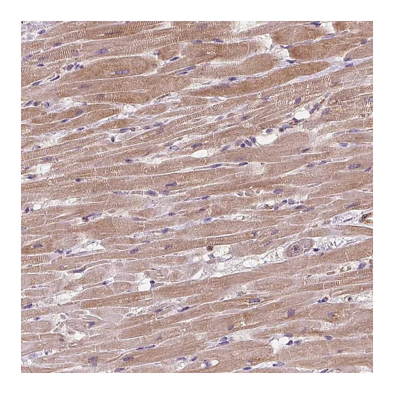 Atlas Antibodies Anti-KCNK15 Antibody