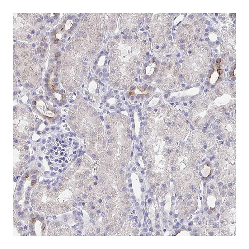 Atlas Antibodies Anti-KCNK5 Antibody