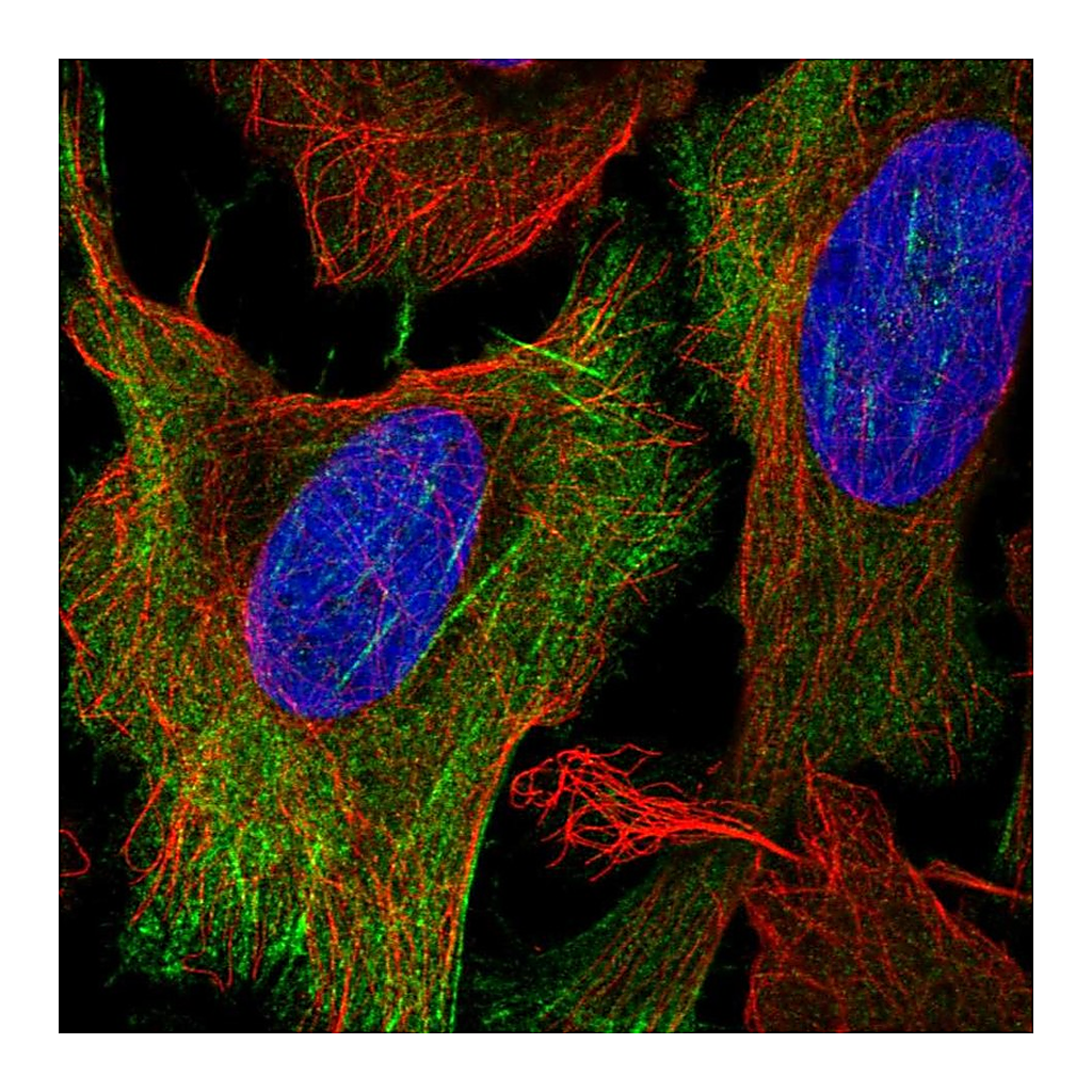 Atlas Antibodies Anti-KCNN1 Antibody