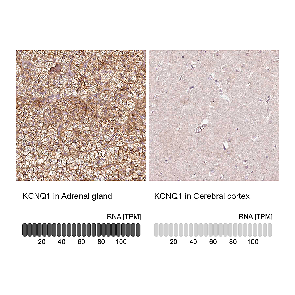 Atlas Antibodies Anti-KCNQ1 Antibody