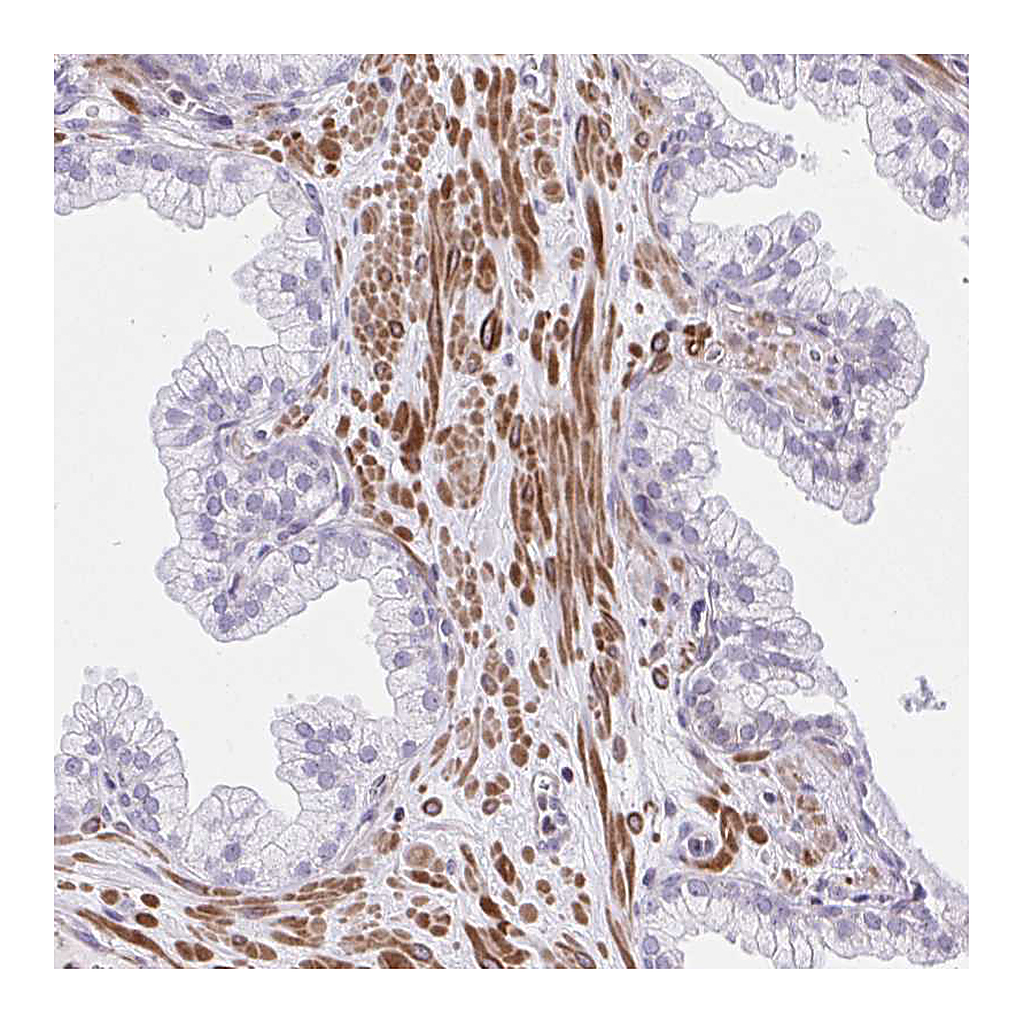 Atlas Antibodies Anti-KCNN4 Antibody