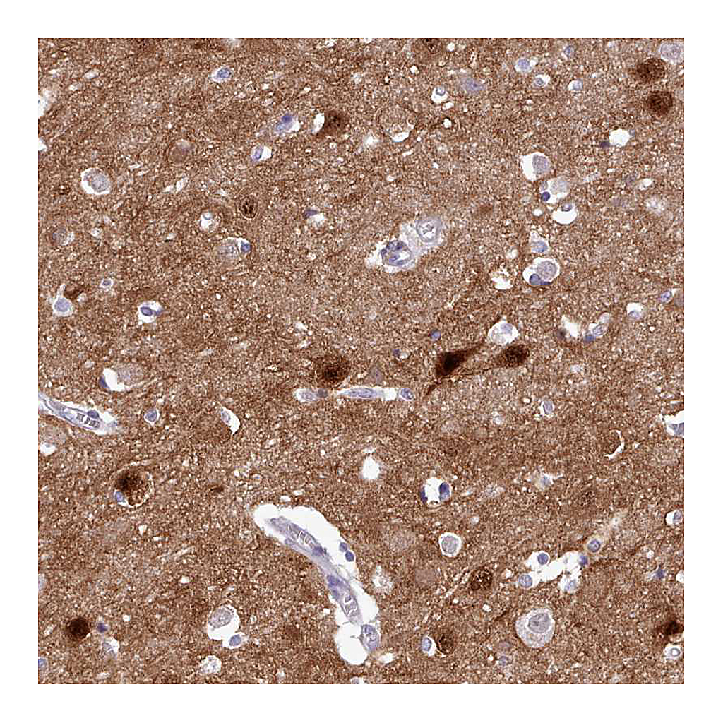 Atlas Antibodies Anti-KCTD16 Antibody