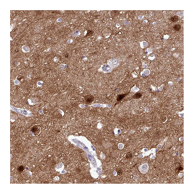 Atlas Antibodies Anti-KCTD16 Antibody