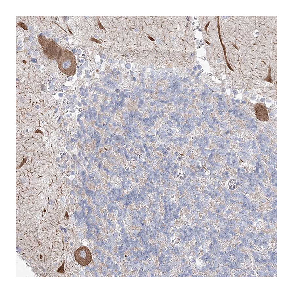 Atlas Antibodies Anti-KCTD6 Antibody