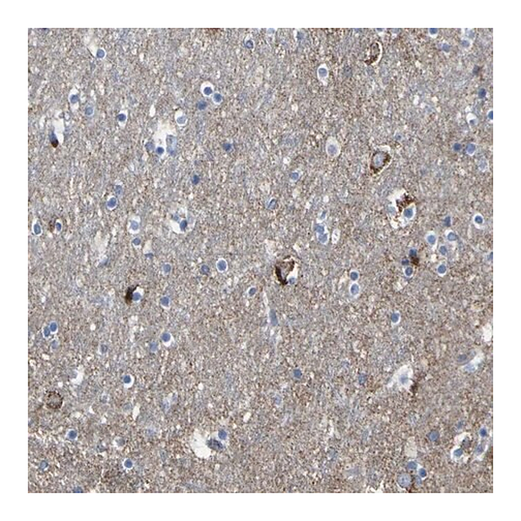 Merck Anti-HK1 antibody produced in rabbit