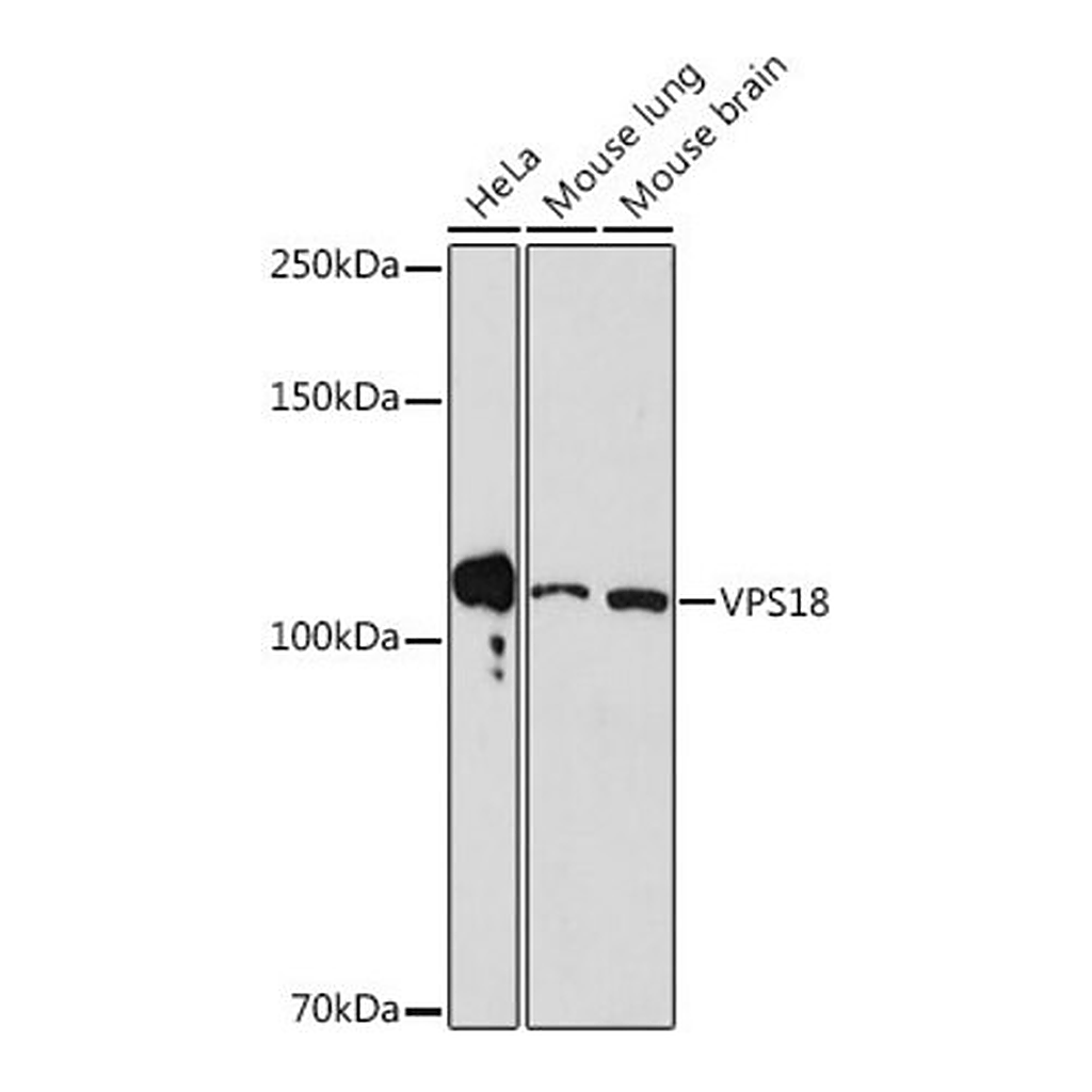 Merck Anti-VPS18 antibody produced in rabbit