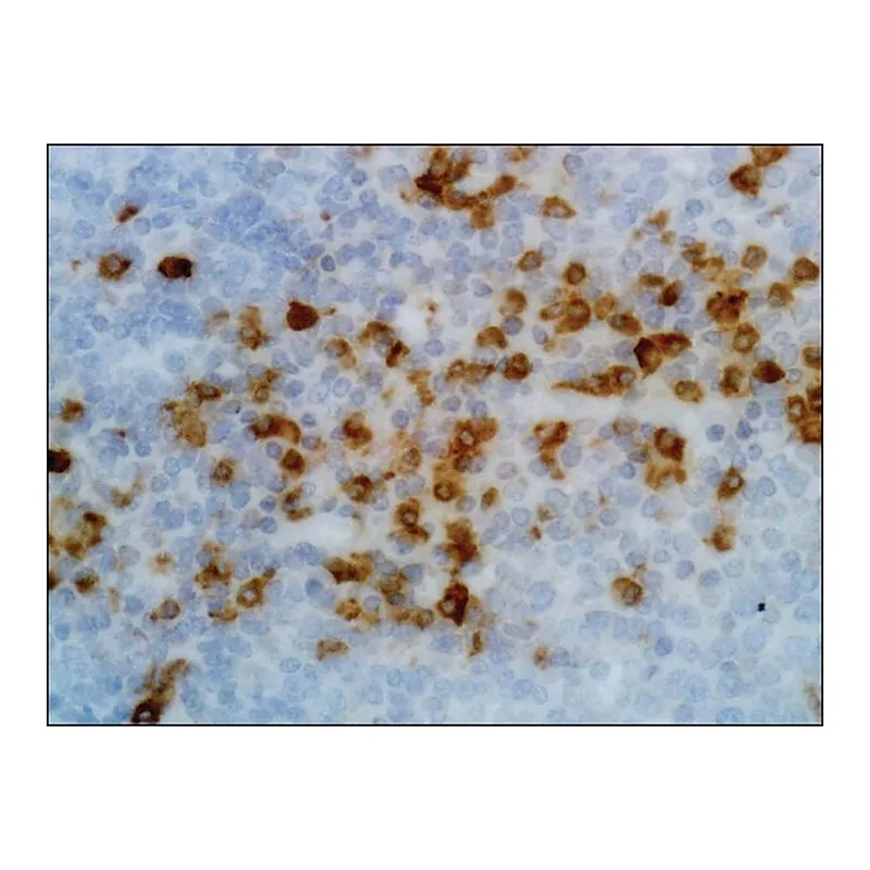 Merck Anti-Human Kappa Light Chain antibody, Rabbit monoclonal