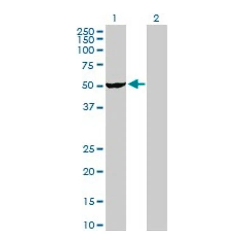 Merck Anti-VRK2 antibody produced in rabbit