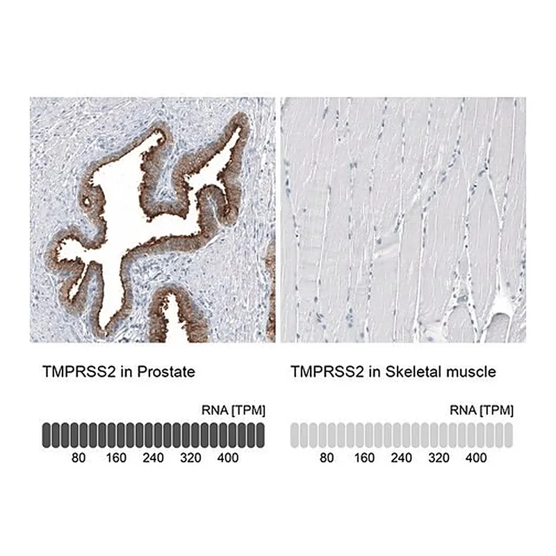 Merck Anti-TMPRSS2 antibody produced in mouse