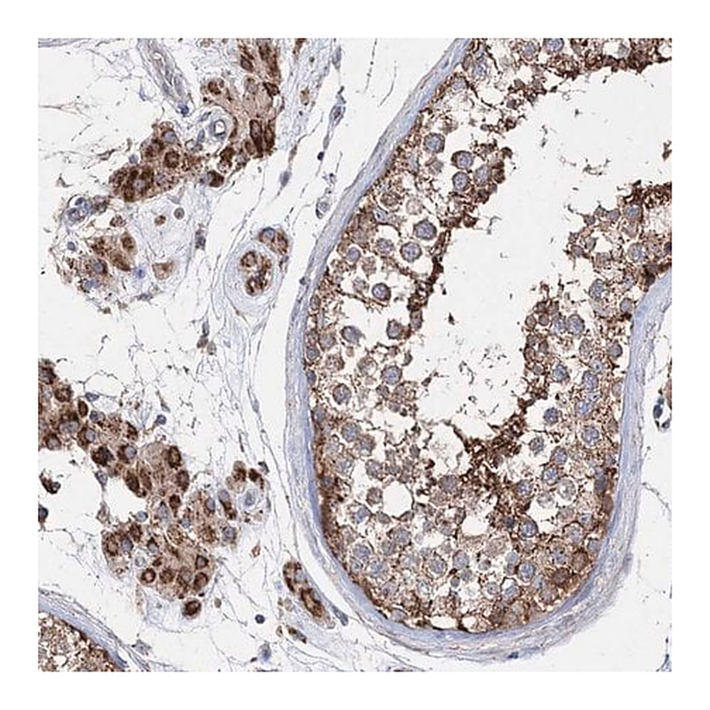 Merck Anti-NGLY1 antibody produced in rabbit