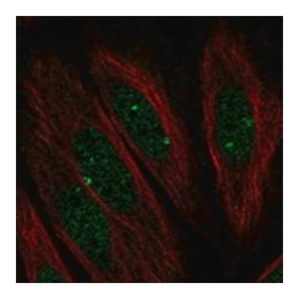 Merck Anti-PARP3 antibody produced in rabbit