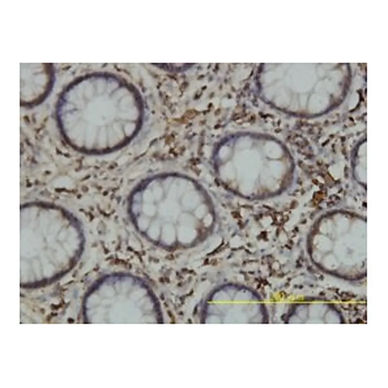 Merck MONOCLONAL ANTI-CALR