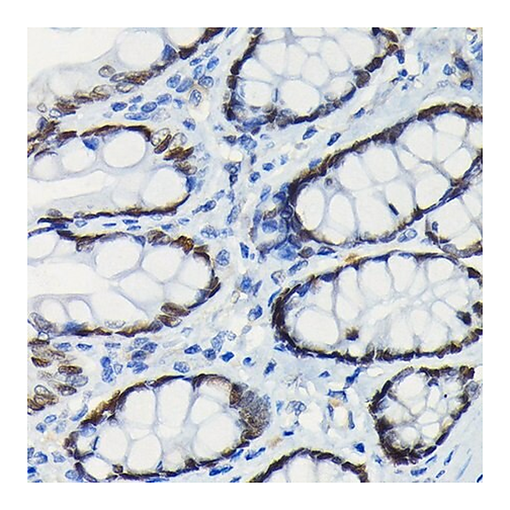 Merck Anti-SATB2 antibody produced in rabbit